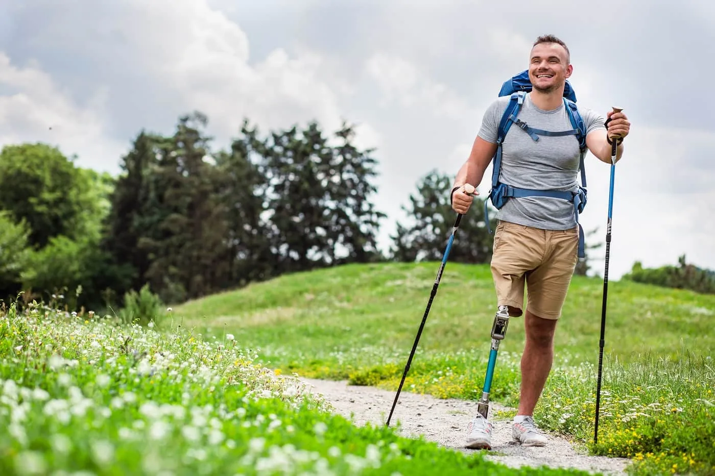 traveling with expert prosthetic support