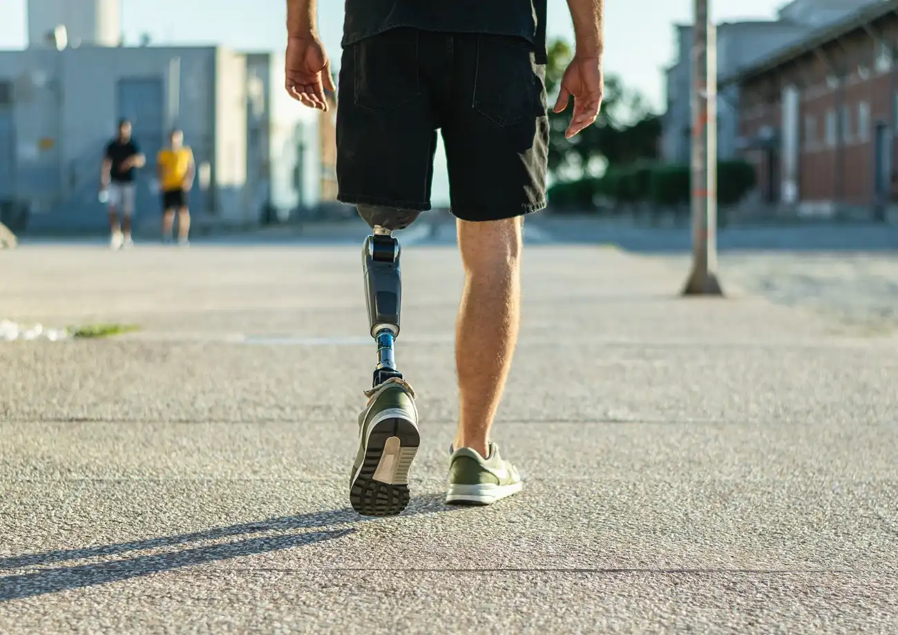 residual limb changes after amputation