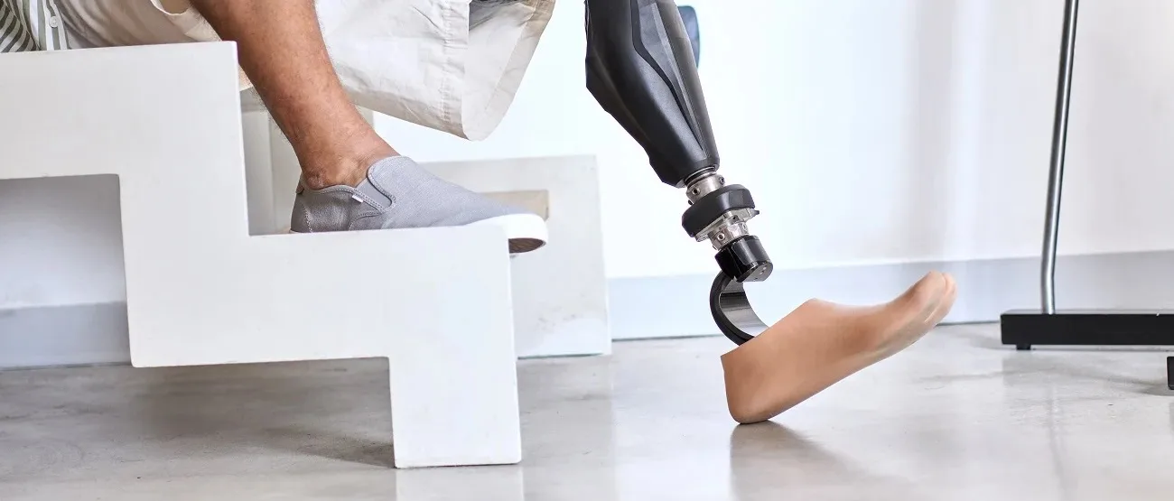 Famous People with Prosthetic Limbs