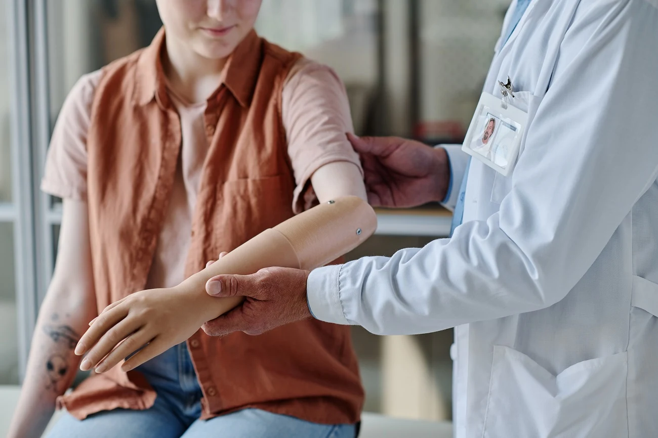 Doctor fitting a prosthetic arm on a patient