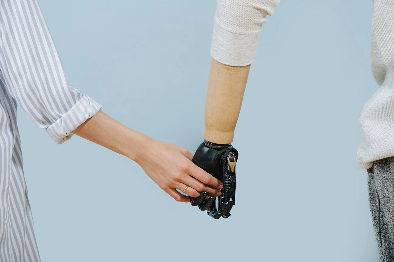 lifestyle with a prosthetic arm