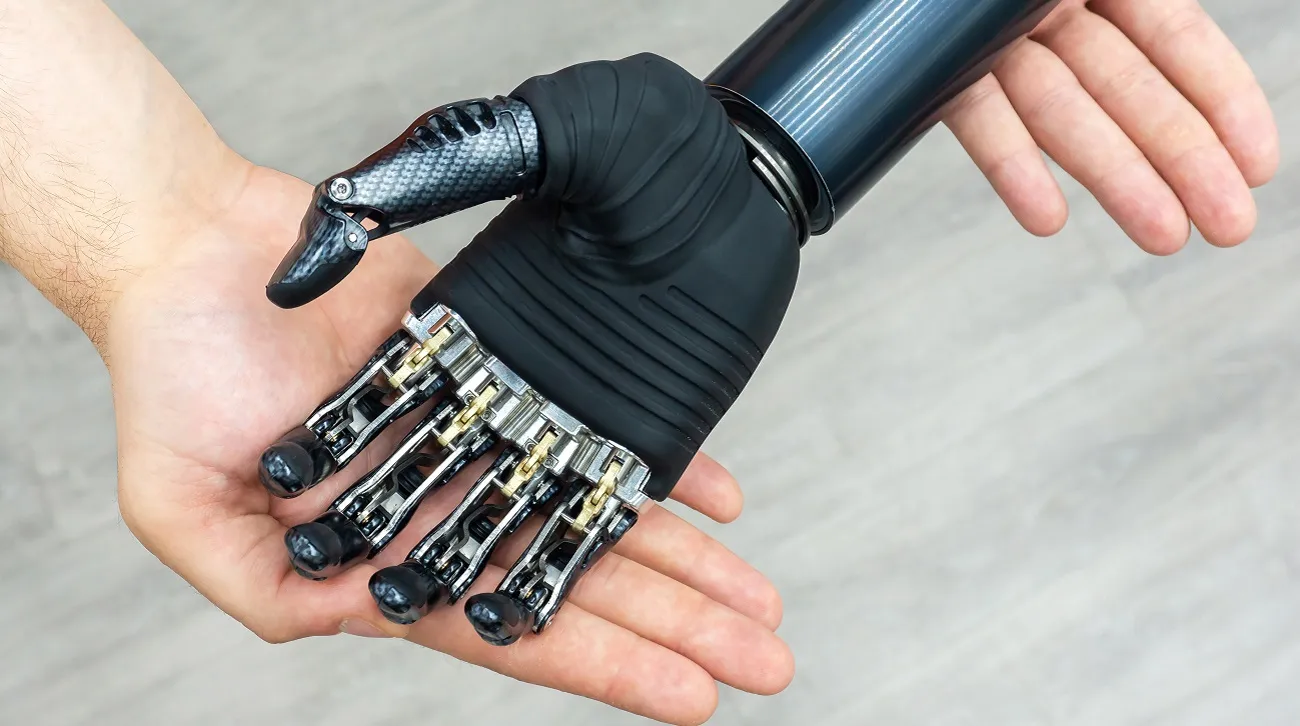 What Are Motion Control Prosthetics?
