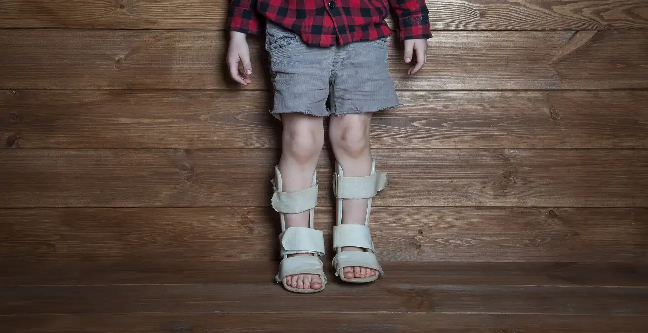 AFO vs. SMO: Which Orthotic Brace Is Right for Your Child?