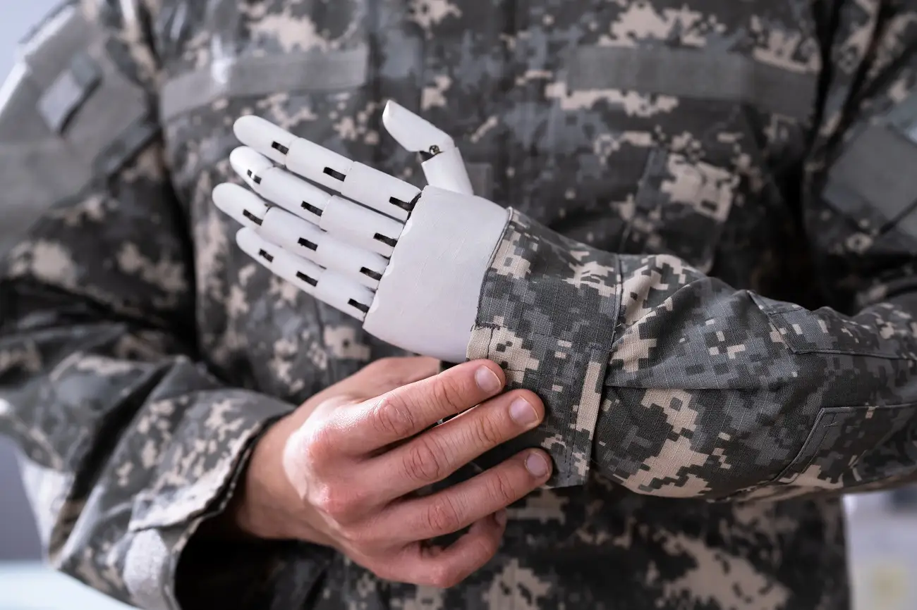 Can an Amputee Join the Military? Exploring Possibilities for Service