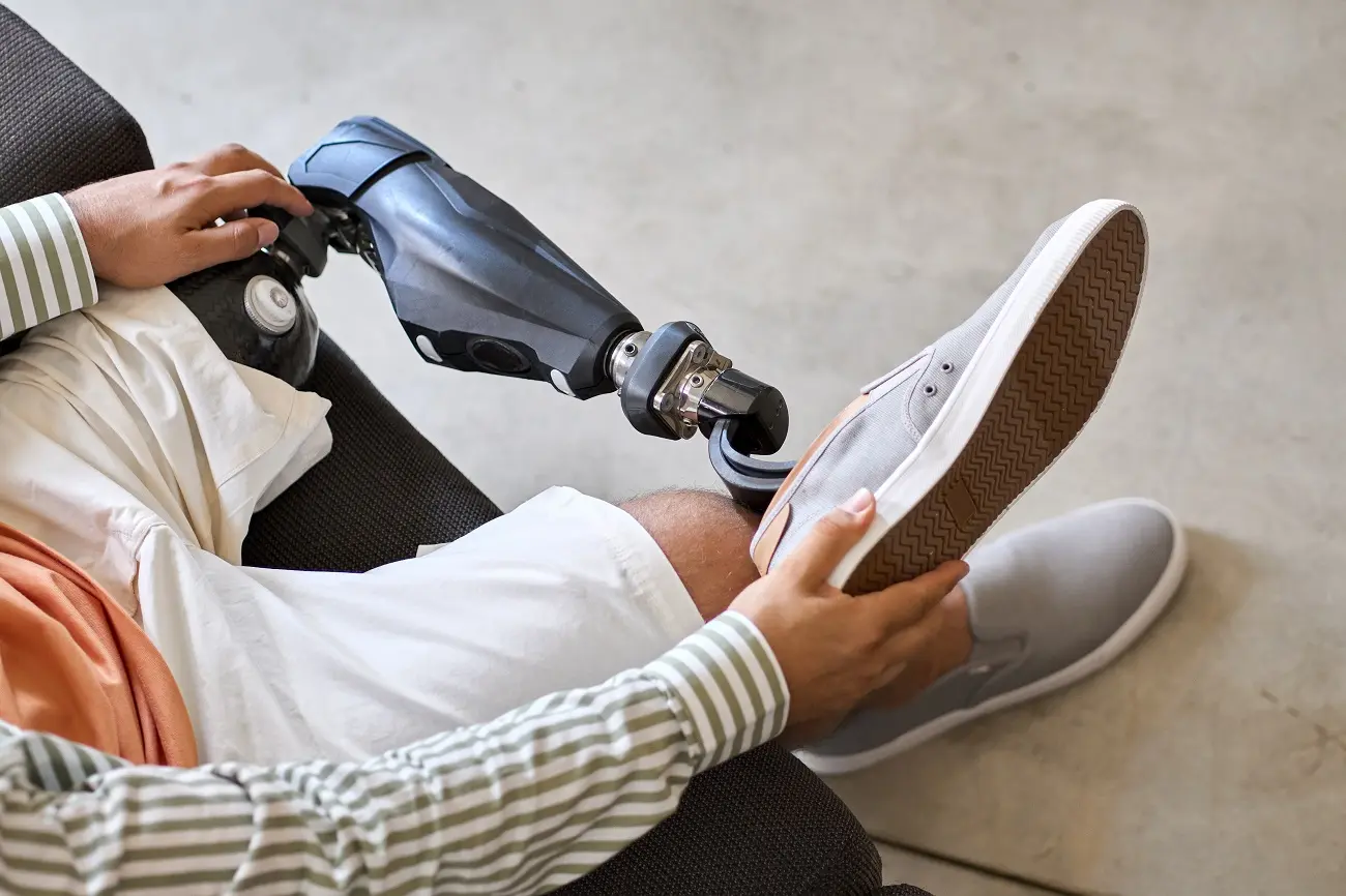 Limber Prosthetics: Revolutionary 3D-Scanned Prosthetic Devices