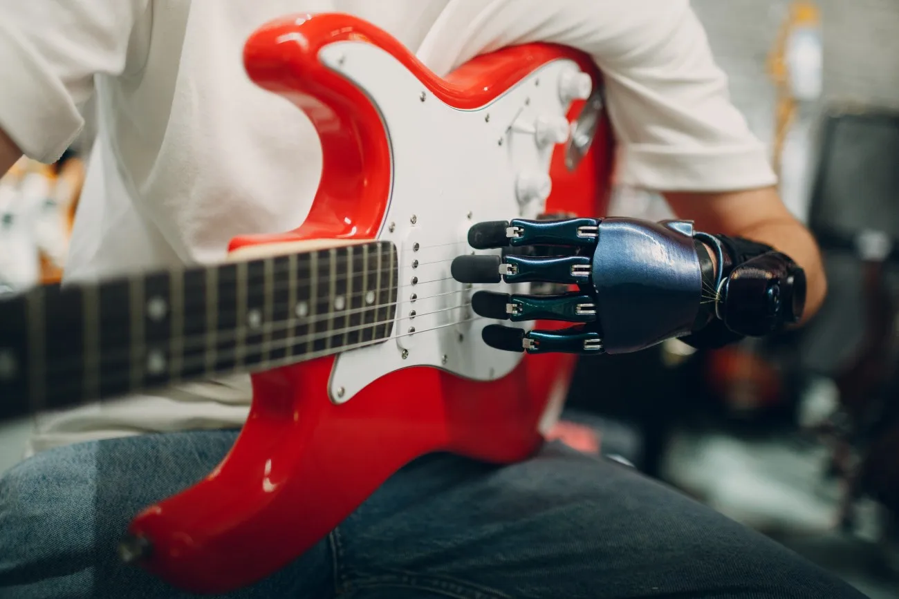 Can You Play Guitar with a Prosthetic Arm? Yes, You Can!