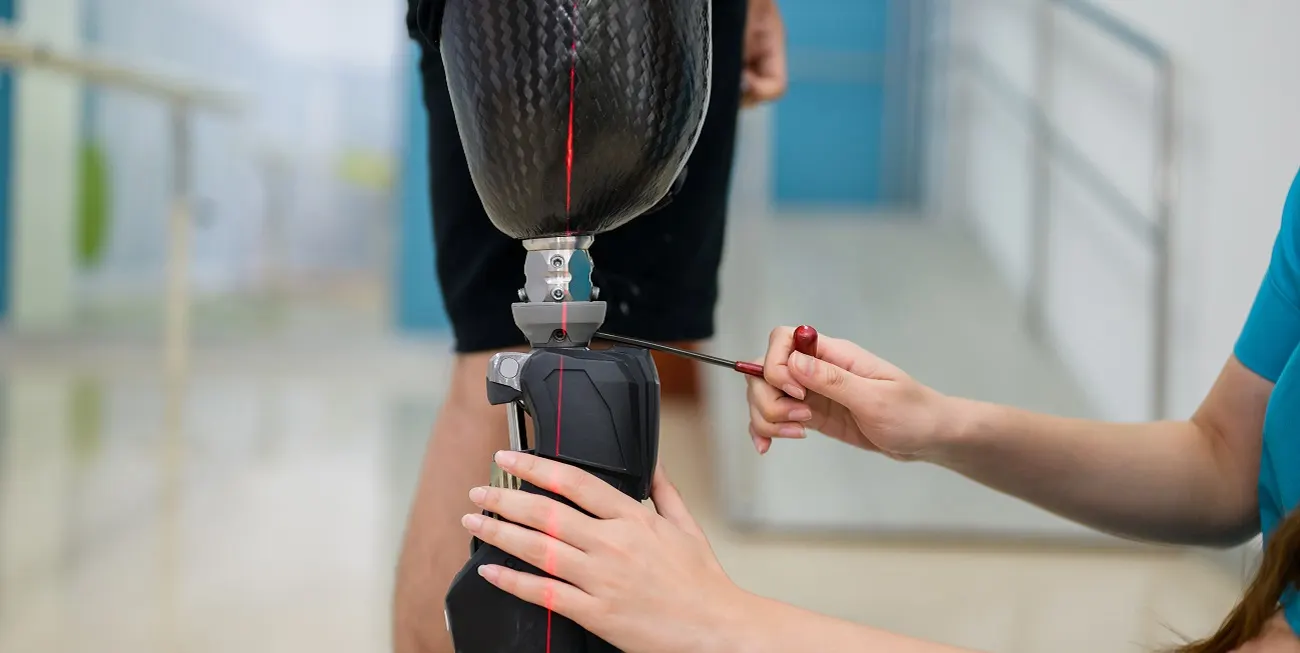 When Should You Recalibrate Your Prosthetic Alignment?