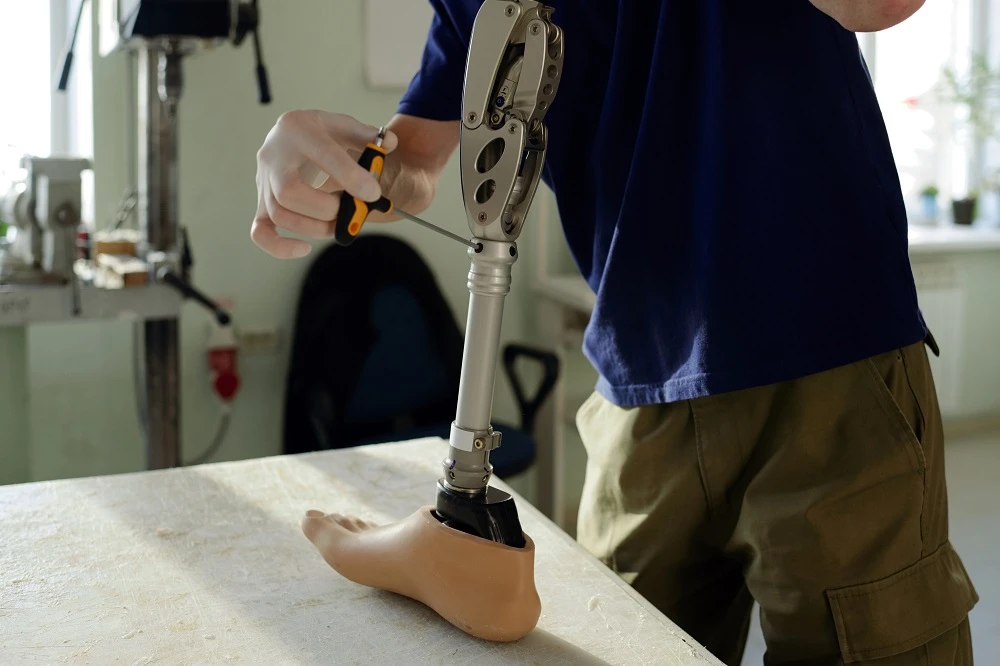 Rediscovering Joy with Prosthetics After Amputation Due to Diabetes