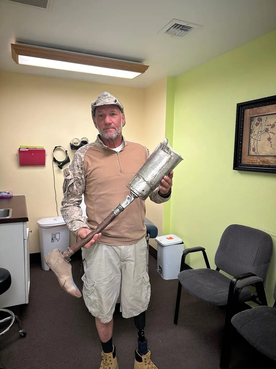 custom prosthetics