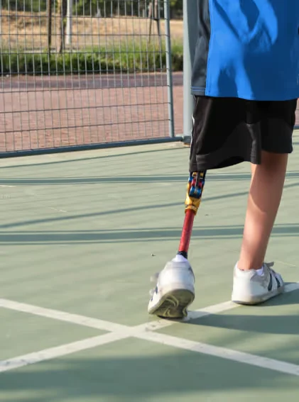 a child with a prosthetic leg.
