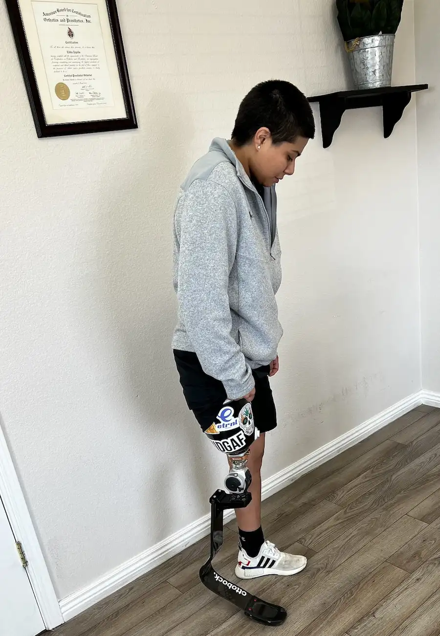 recovery after amputation