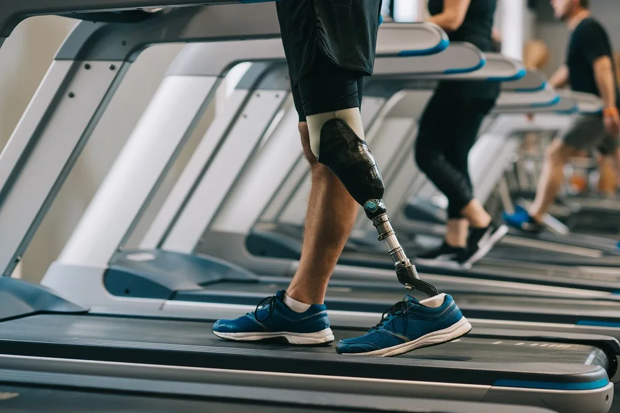 Person with a below-knee prosthetic leg walking on a treadmill in a gym