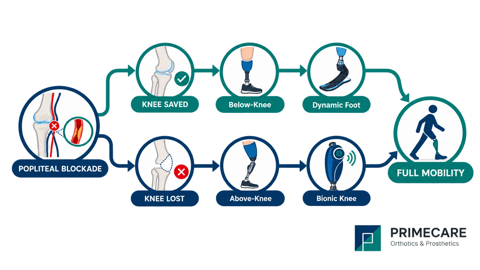 Popliteal blockade