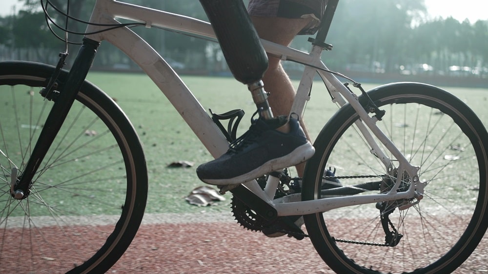 Cycling with Lower Limb Amputation