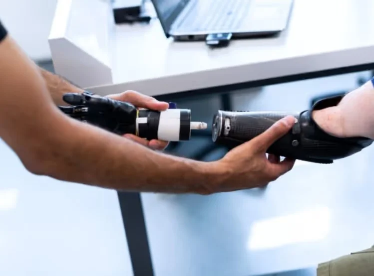 Upper Limb Prosthetics for First-Time Amputees