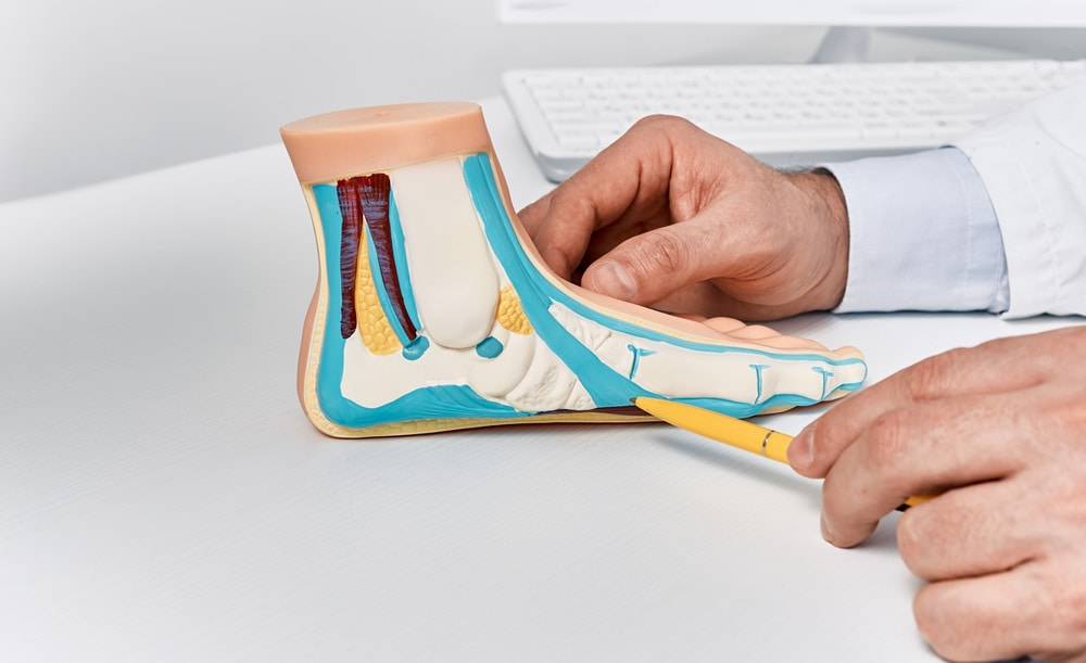 flat foot model