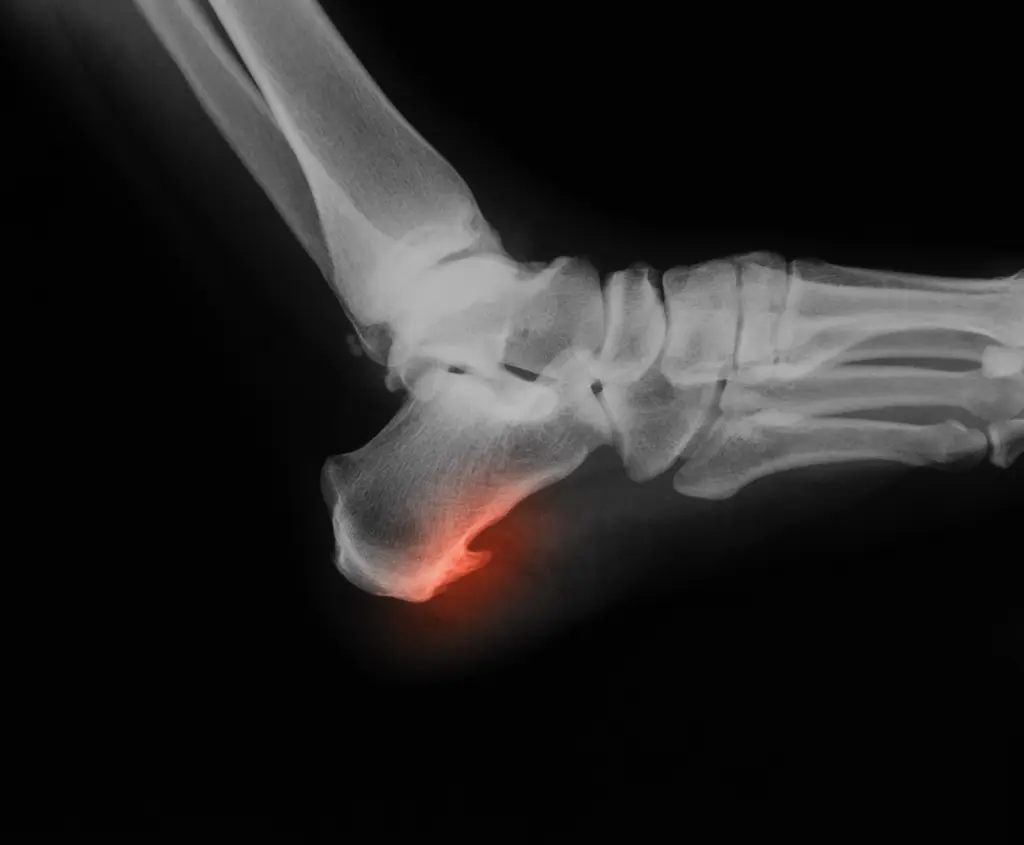 foot and ankle problems elderly