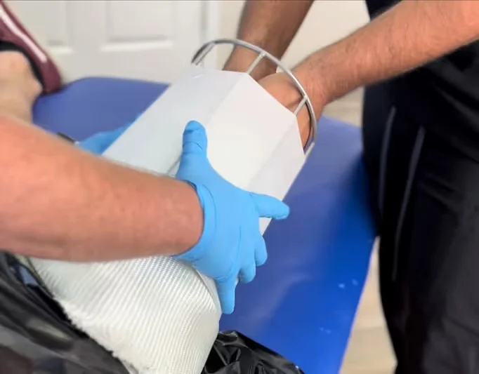 Prosthetic Socket