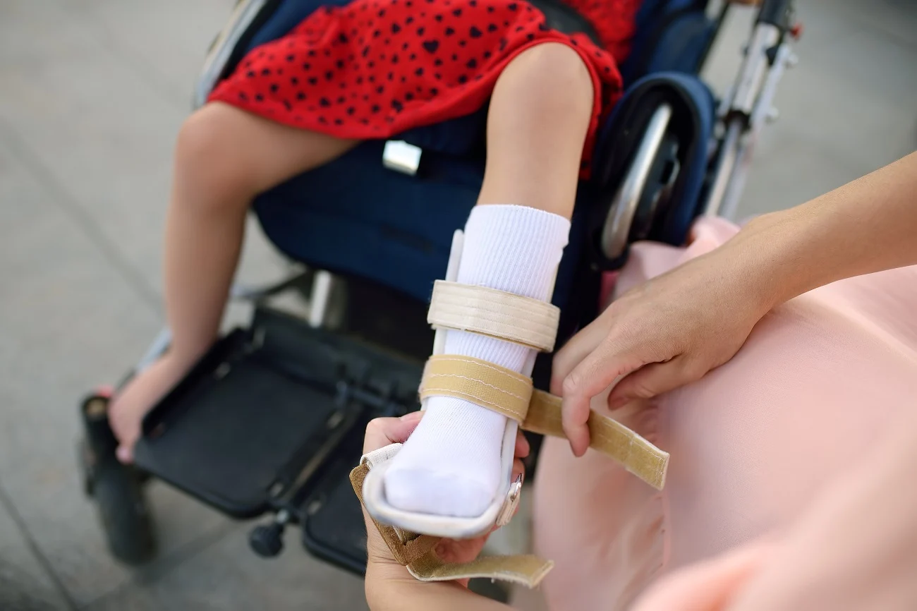 Un niño en silla de ruedas lleva una ortesis supramaleolar que se le está ajustando en la parte inferior de la pierna.